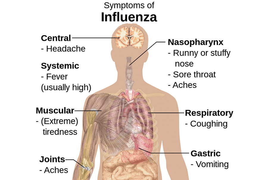 SSM records 2 serious COVID-19 & 1 flu cases